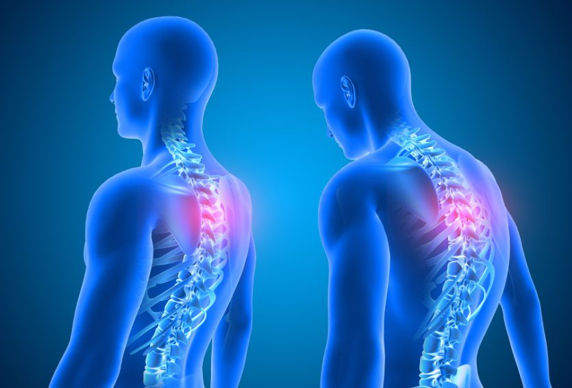 The Connection Between Spinal Alignment and Posture: Tips for Prevention