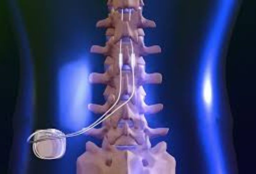 Advancements in Spinal Cord Stimulation: Closed-Loop Systems and Real-Time Feedback