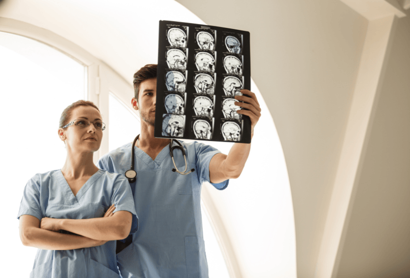 Endovascular Treatment of Brain Aneurysms: A Less Invasive Option for Patients
